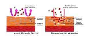 Comparison of normal versus disrupted skin barrier function.